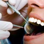 Why the Order You Consume Foods During Meals Dramatically Affects Dental Erosion Risk